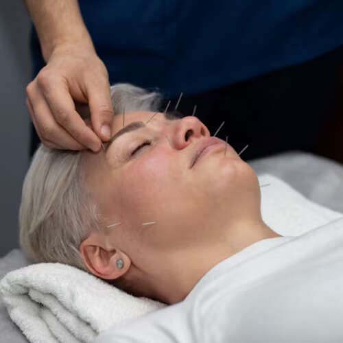 Acupuntura 04